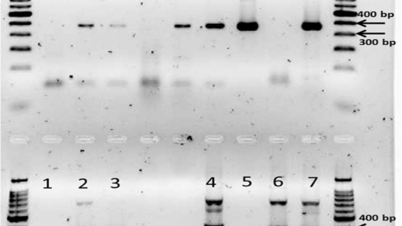 RT CTR for simultaneous detection of pepper chat fruit viroid c Springer